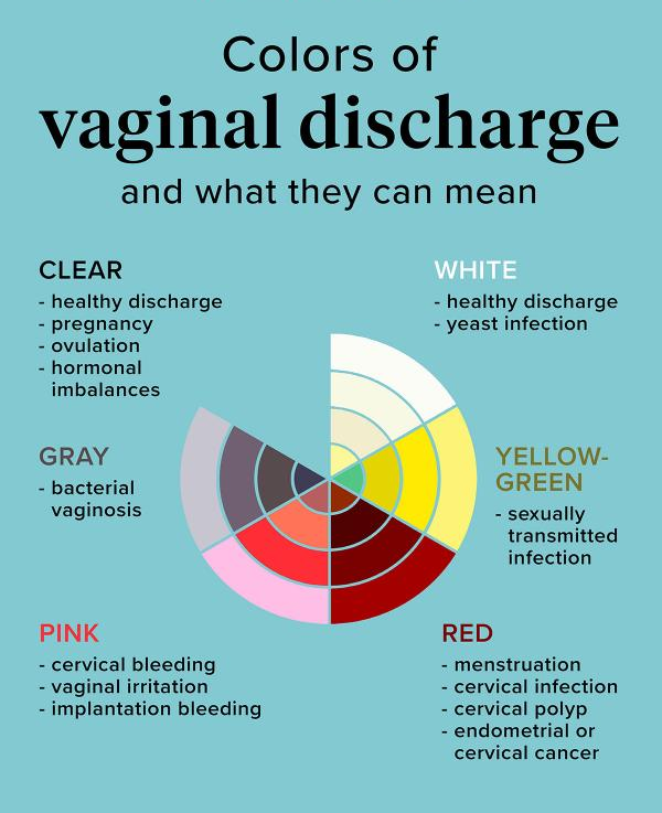 Is Vaginal Discharge A Small Matter?